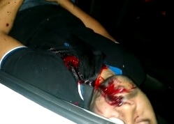 Man shot in the face and chest agonizes to death inside his car