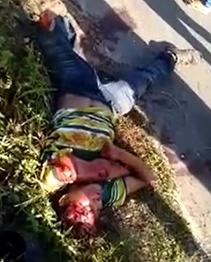 Guy Fucked up by Guard Rail