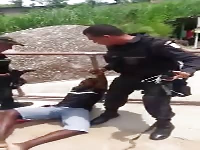 Thug was shot in the ass and the bullet broke his femur