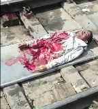 Man Perfectly Severed in Half Removed From the Rails