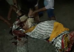 Womans Face Totally Crushed