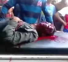 Guy Agonizes with his Face Crushed