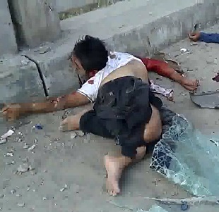 Man Twisted into a Pretzel Dead Next to His Friend