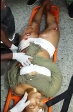 Woman in Tight Shorts with Gash on her Ass his Helped While in Agony