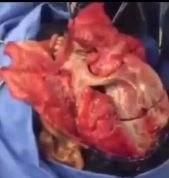 Face Turned into a Mask