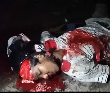 Kid Scalped to the Skull Lies Dead on the Street 