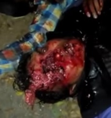 Peopled Fucked up and Close up on a Face