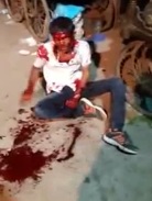 Dude Hacked up with Machete in 100% Shock