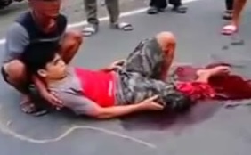 Friend Comforting his Buddy after his Leg is Ripped To Shreds