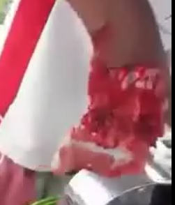 Calm Dudes Hands Totally Crushed in Machine .. Watch it Come out