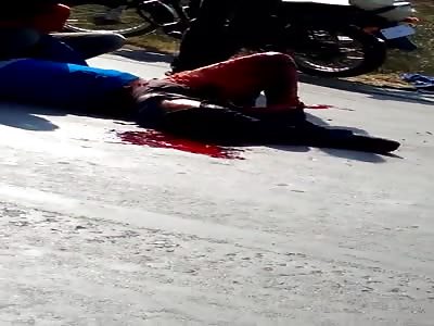 Dude with Leg Skinned in Total Pain