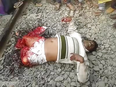 Man Still Alive with Both Legs Cut Off in Agony Begging for Help