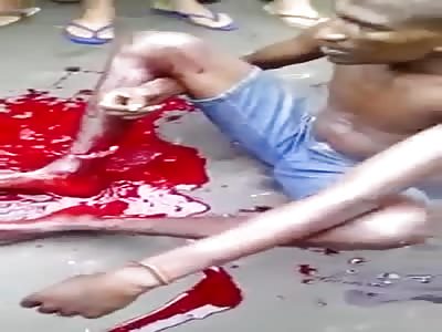 Man Was Caught Stealing and Has his Ankles Cut by Machete