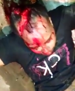 Man Chopped in Head with Machete...Still Alive and in Shock, His Scalp a Few Feet Away 