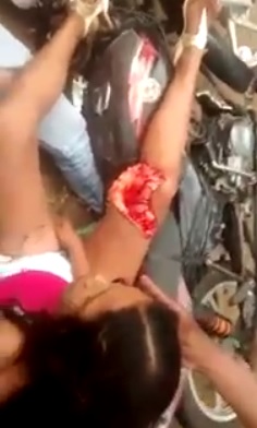 Cute Girl with Gash in her Leg