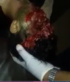 Dude Agonizes with Shots to the Face... Crowd is in Awe