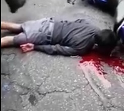 Boy Agonizes Then Dies after Accident