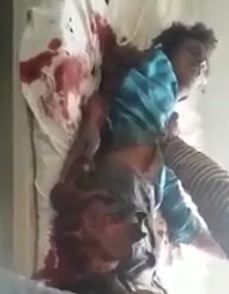 Kid in Total Agony with Arm and Leg Ripped apart by Train