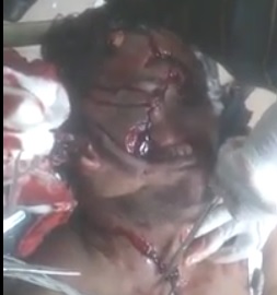 Trying to Figure out Mans Deformed Face After Accident 