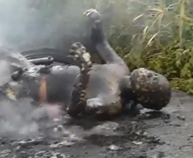 Dude Burnt to an Absolute Crisp