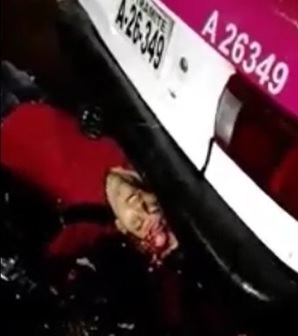 Dude Has Serious Head Trauma Stuck Under Car after Accident