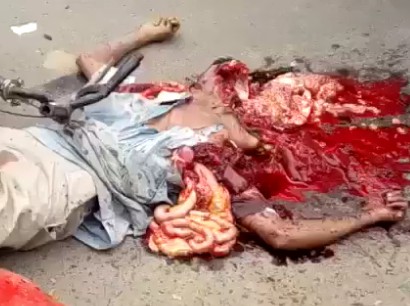 Man Horribly Crushed Pieces of his Body Stuck all Over the Truck