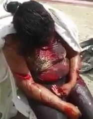 Woman Hacked up by Machete Blows Waits for Help