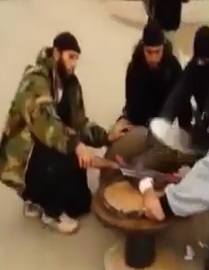 Guy has His Hand Cut Off