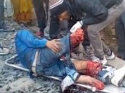 Man in Agony with Legs Ripped off by Train