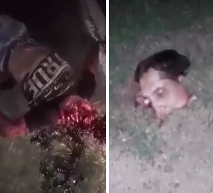 DAMN: Man Loses His Face in Horrific Accident