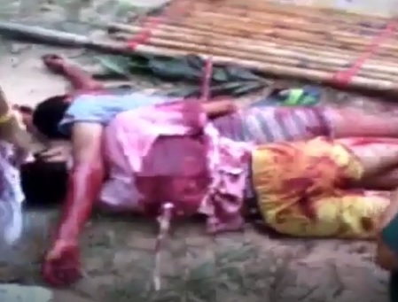 SHOCKING:  Two Kids Impaled Together  through the Stomach 