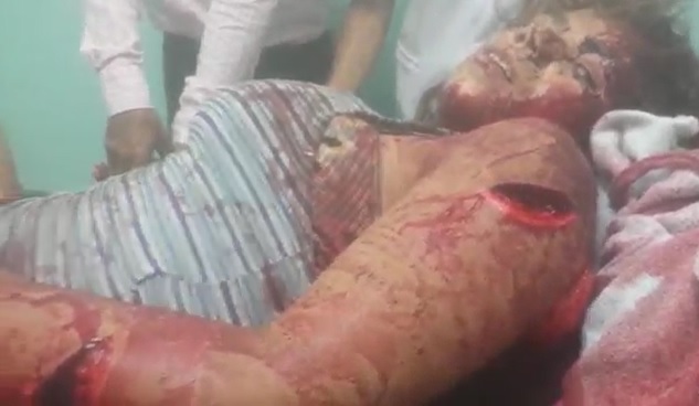 Woman Hacked Up with Machete Waits for Help