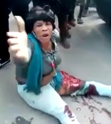 Lady with Leg Wound Doesn't Want to Be Filmed