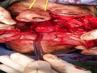 Horrific Mouth Injury