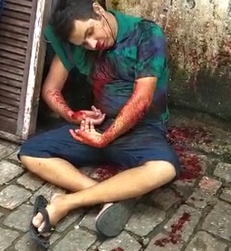 Boy Shot Gives His Last Breath on Camera Before Dying 