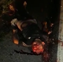 AFTERMATH: Dude Fucked Up From Accident