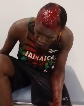 Dude Scalped by a Machete