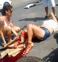 Womans Leg Crushed as She Lays in Shock