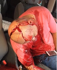 Crime Scene Dude Barley Alive Gasping For Life