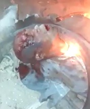 BRUTAL: Necklaced, Set on Fire, Burned Alive (Prep Work Included)