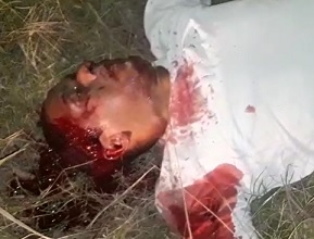 Dying Man Fighting to Stay Alive... Gasping