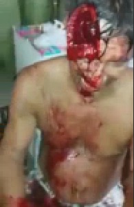 Work Accident Leaves Dude Fucked Up