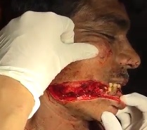 Given the Joker Smile