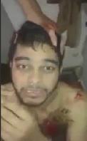 Dude is Savagely Tortured 