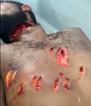 Street Juggler Stabbed Nearly Beheaded (Performance in Comments)