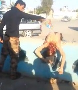 Daesh Almost Beheaded Then Set on Fire