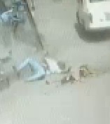 Bizarre Work Accident