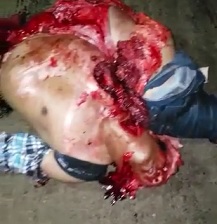 Just a Flesh Wound... See if You can Walk It off Homie