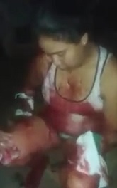 Woman Sliced up with Machete