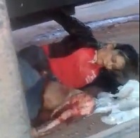 OUCH! Girl Still Alive Under Truck, Leg SHREDDED 